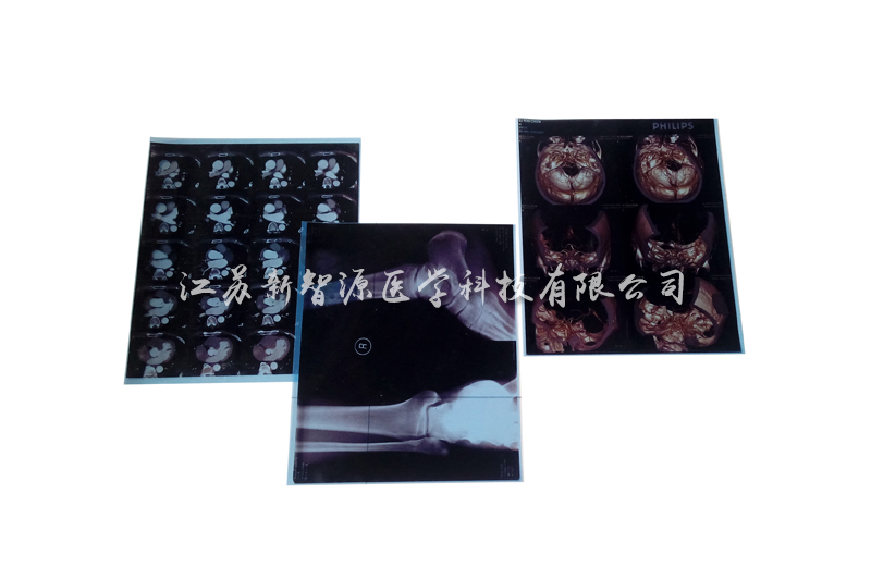 医用打印胶片